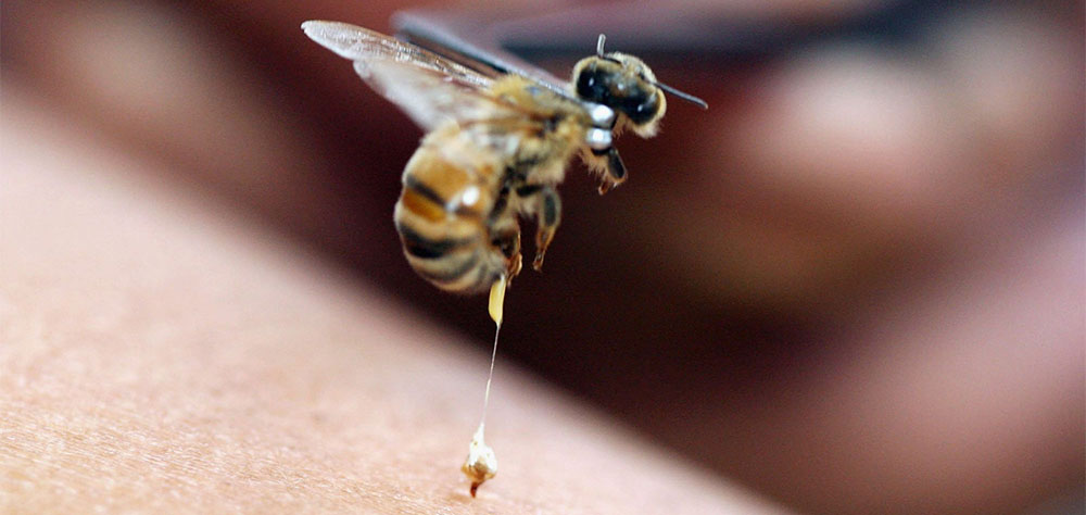 The Amazing Benefits of Bee Venom